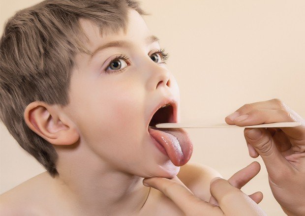 Menino a ser diagnosticado com amigdalite por um médico.