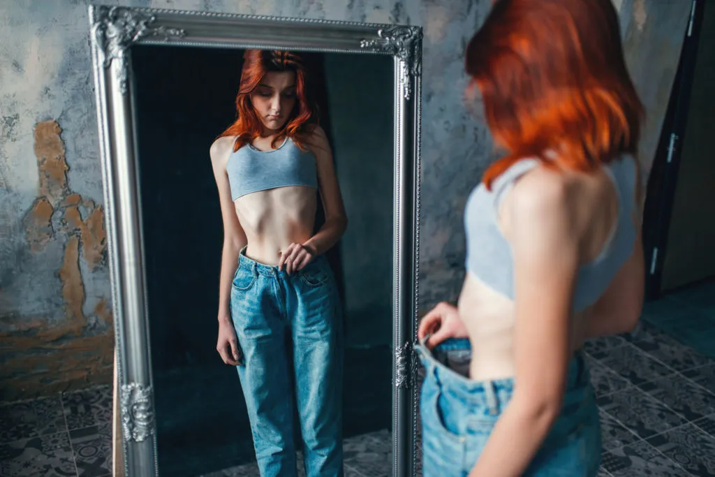 Mulher jovem com anorexia nervosa
